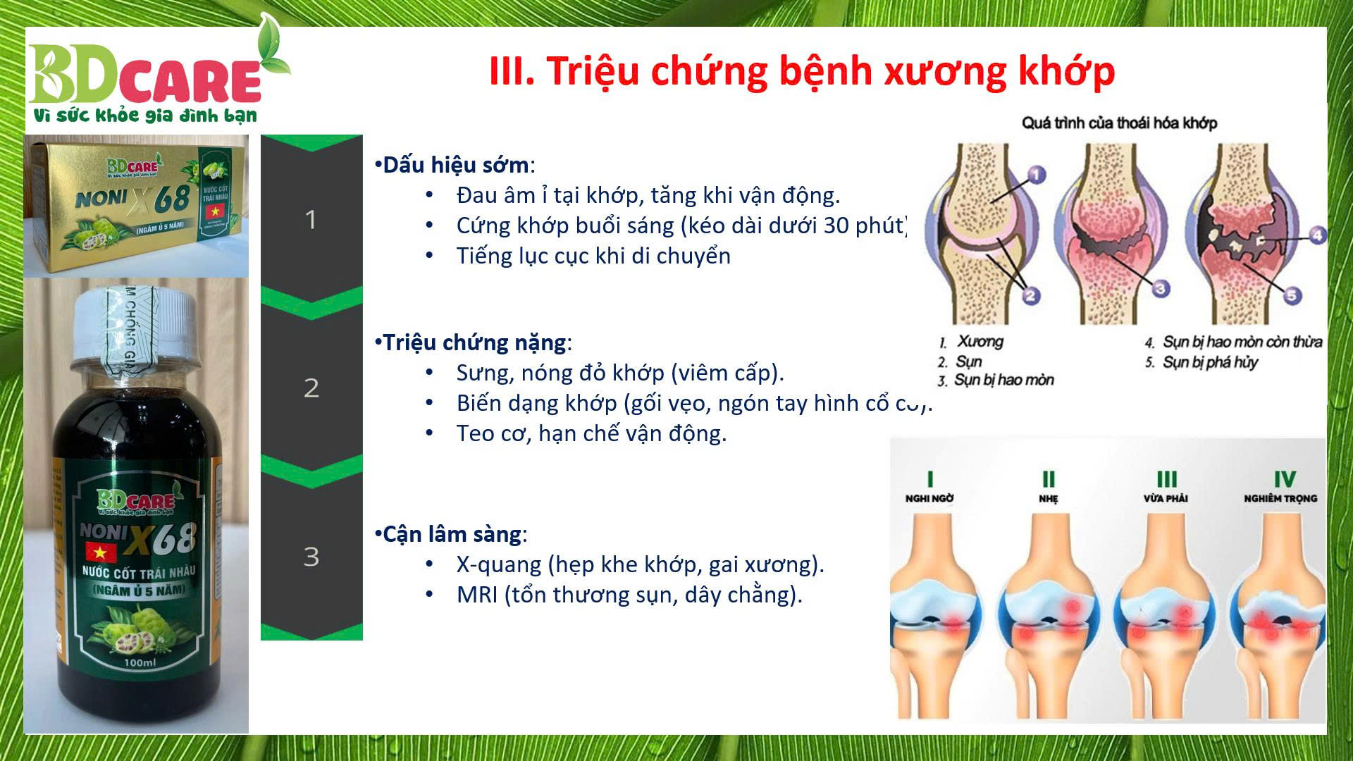 XƯƠNG KHỚP KHÔNG CÒN LÀ NỖI LO KHI BIẾT TỚI BDCARE